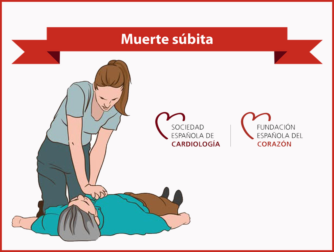 España y la Muerte Súbita